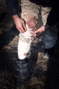 Bloodied leg from violence at border zone © Fresh Response