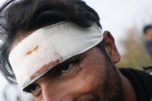 man with bloody bandaged head